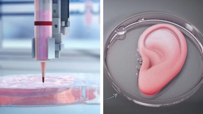 Unbelievable results of 3D printing in Health Sector